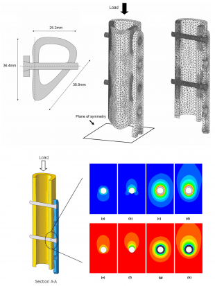 Multipanel figure showing FE fracture model setup and resulting strains plots around the screw holes.